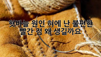 혓바늘 원인: 혀에 난 불편한 빨간 점, 왜 생길까요?